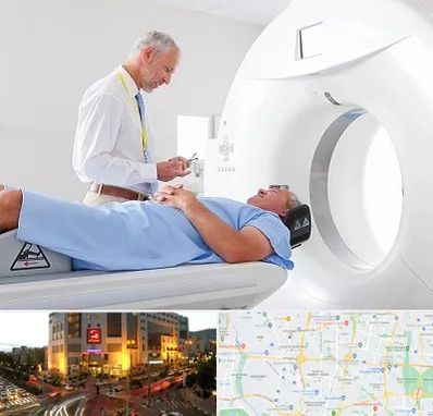 سی تی اسکن در جنت آباد تهران 