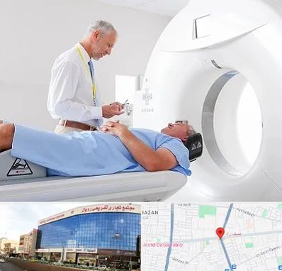 سی تی اسکن در نصف راه تبریز