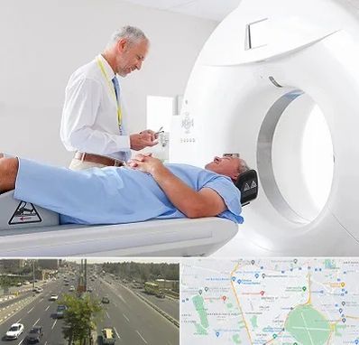 سی تی اسکن در منطقه 17 تهران