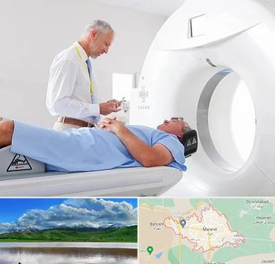 سی تی اسکن در مرند