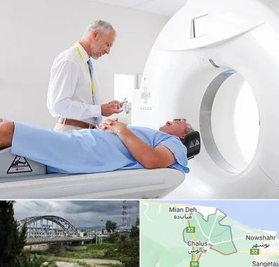 سی تی اسکن در چالوس