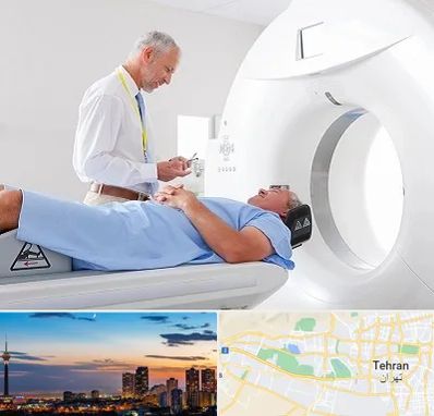 سی تی اسکن در غرب تهران 