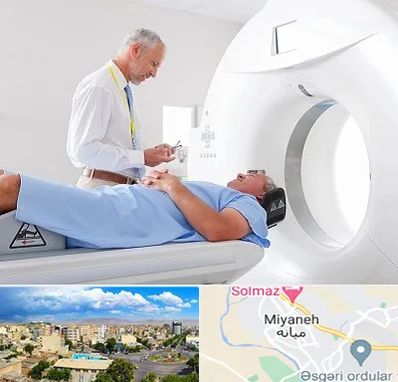 سی تی اسکن در میانه