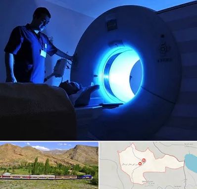 ام ار ای در خاش