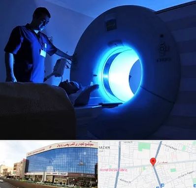 ام ار ای در نصف راه تبریز