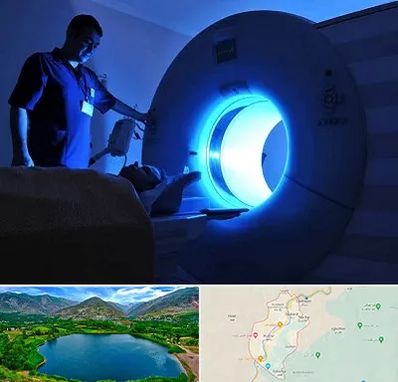 ام ار ای در رودبار