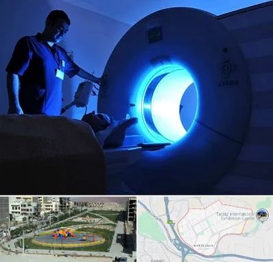 ام ار ای در مرزداران تبریز