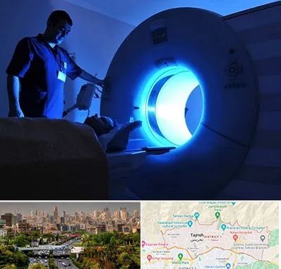 ام ار ای در منطقه 1 تهران