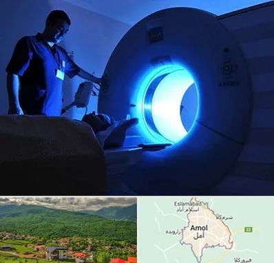 ام ار ای در آمل