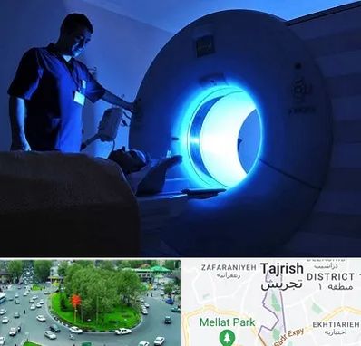 ام ار ای در تجریش 