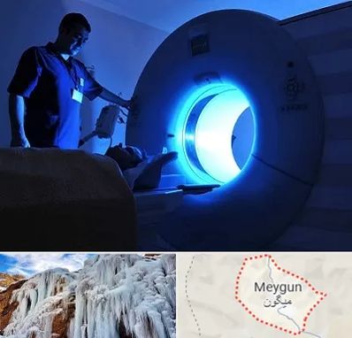 ام ار ای در میگون