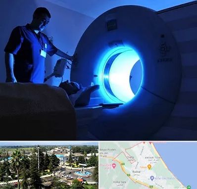 ام ار ای در رودسر