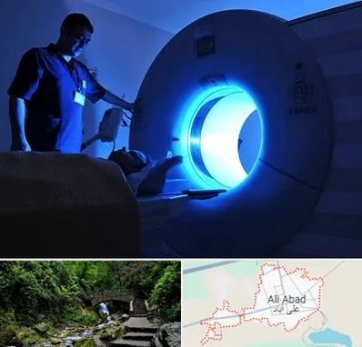 ام ار ای در علی آباد کتول