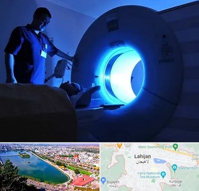 ام ار ای در لاهیجان