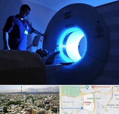 ام ار ای در گیشا 