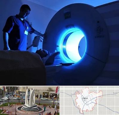 ام ار ای در زابل