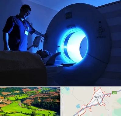 ام ار ای در نکا