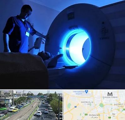 ام ار ای در جنوب تهران 