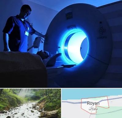 ام ار ای در رویان