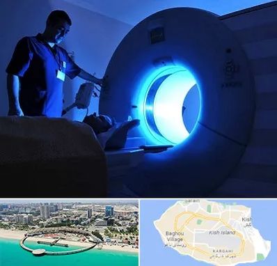 ام ار ای در کیش