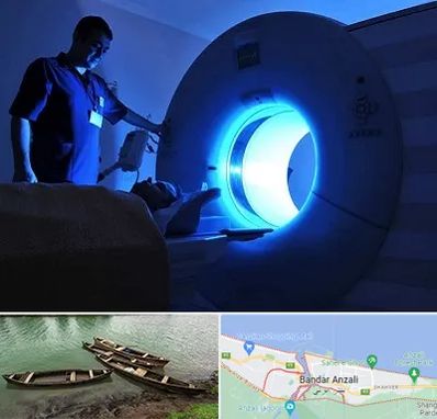 ام ار ای در بندر انزلی