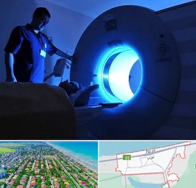 ام ار ای در نور