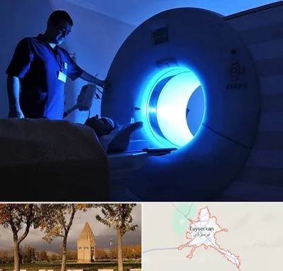 ام ار ای در تویسرکان