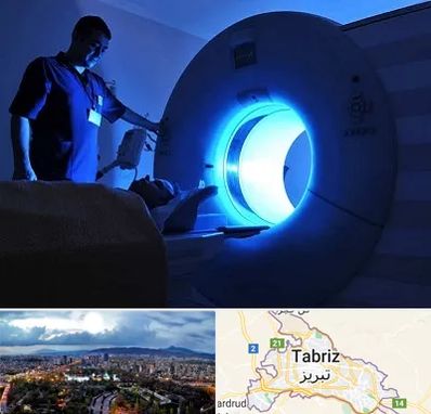 ام ار ای در تبریز