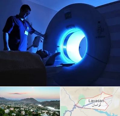 ام ار ای در لواسان