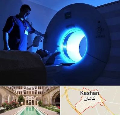 ام ار ای در کاشان