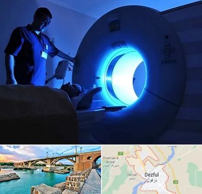 ام ار ای در دزفول