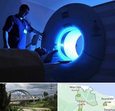 ام ار ای در چالوس