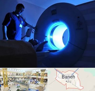 ام ار ای در بانه