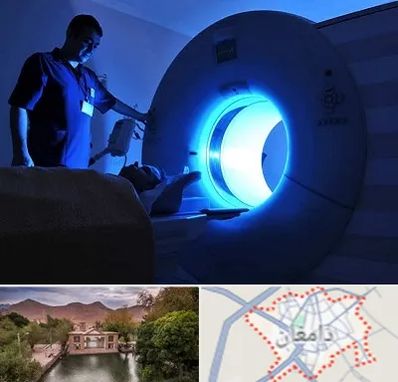 ام ار ای در دامغان