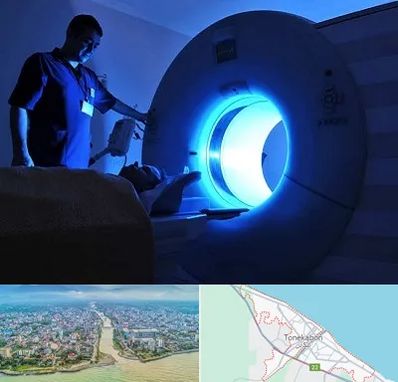 ام ار ای در تنکابن