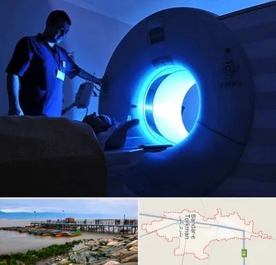 ام ار ای در بندر ترکمن