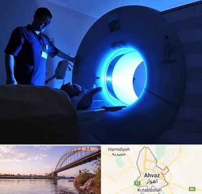 ام ار ای در اهواز