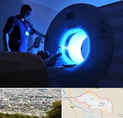 ام ار ای در یاسوج