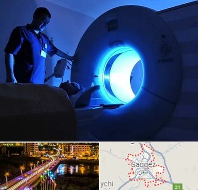 ام ار ای در سقز