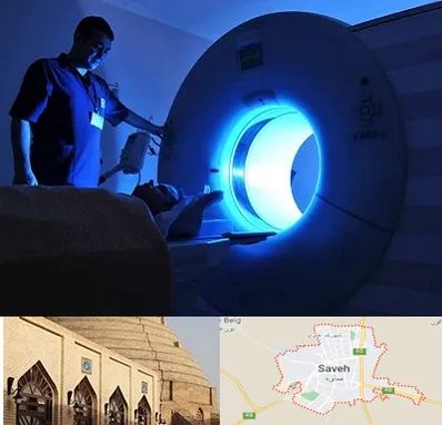 ام ار ای در ساوه