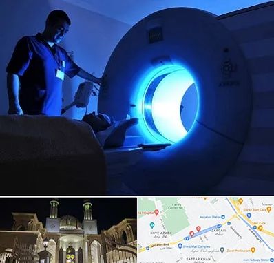 ام ار ای در زرگری شیراز