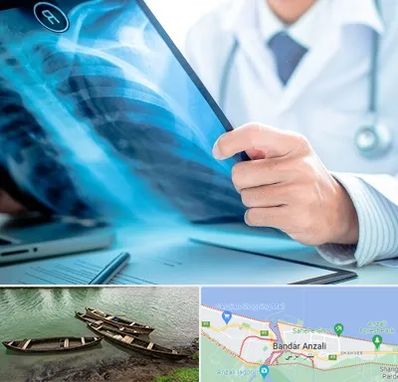 رادیولوژیست در بندر انزلی