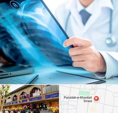 رادیولوژیست در 15 خرداد