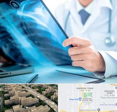 رادیولوژیست در اکباتان 