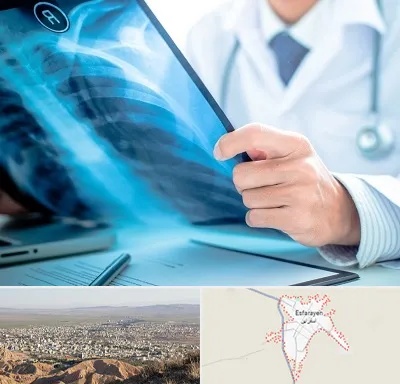 رادیولوژیست در اسفراین