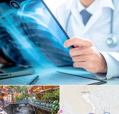 رادیولوژیست در درکه