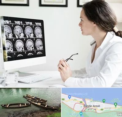 رادیولوژیست خانم در بندر انزلی