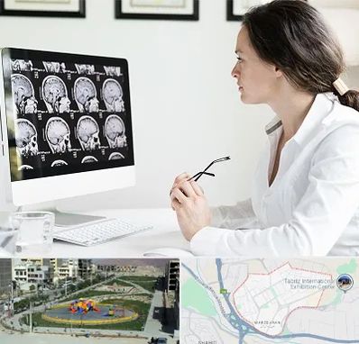 رادیولوژیست خانم در مرزداران تبریز