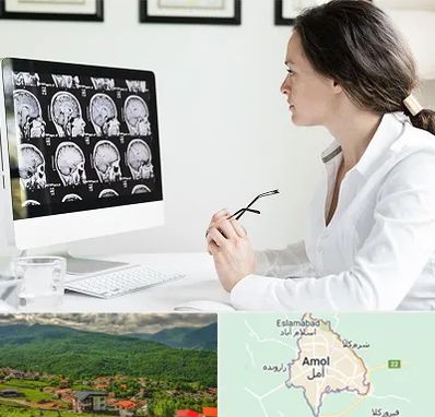 رادیولوژیست خانم در آمل