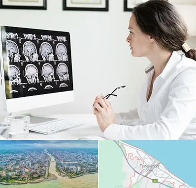 رادیولوژیست خانم در تنکابن